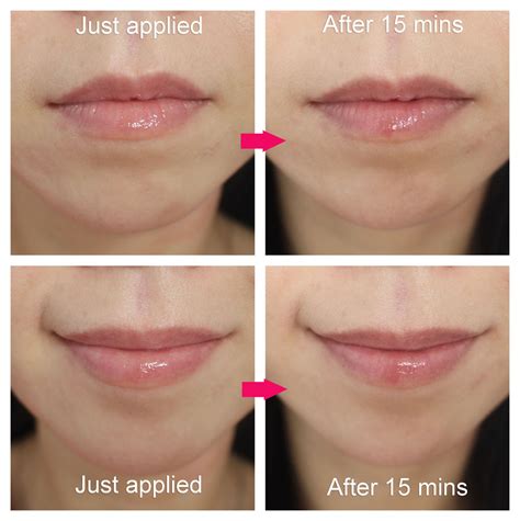 does dior lip maximizer cause tooth sensitivity|Dior lip plumper.